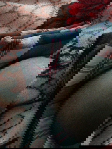 kesehatan kepala bayi dan perkembangannya