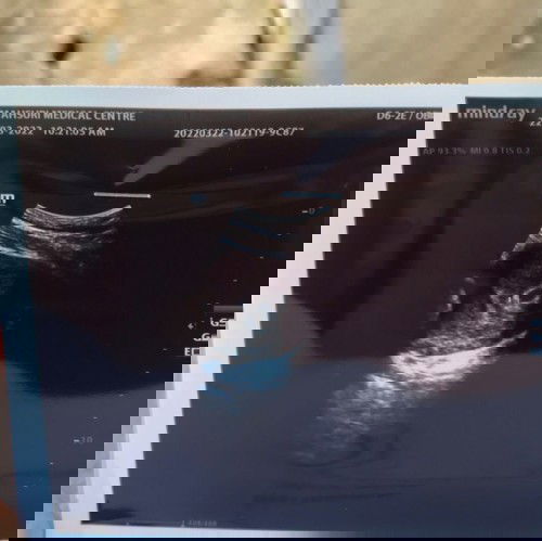 Kiraan 7w tapi scan 4w5d