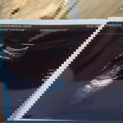 Kiraan 7w tapi scan 4w5d