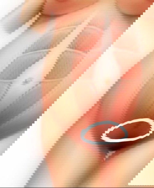 ตั้งครรภ์37+5week