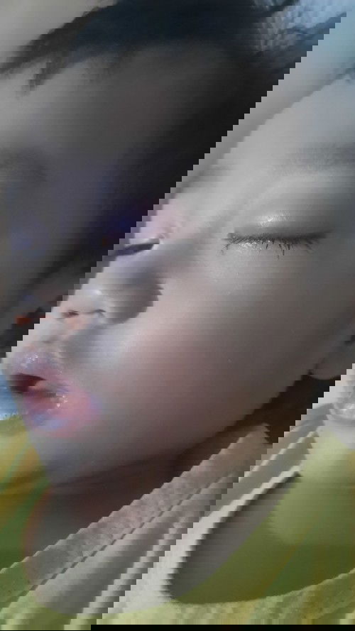 Sakit mata pada anak