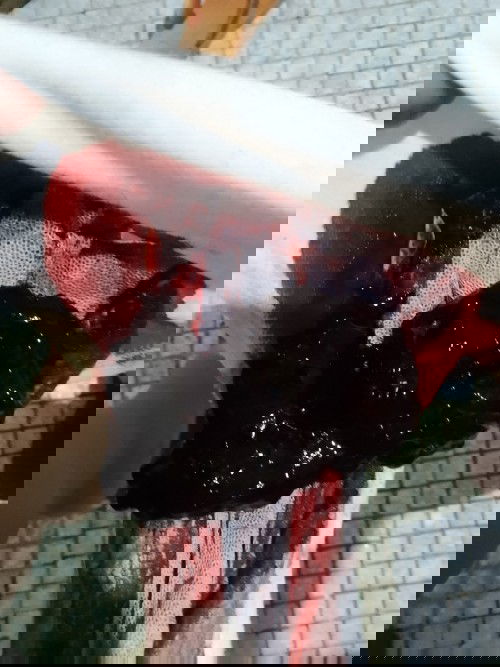 Post partum heavy bleeding