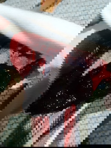 Post partum heavy bleeding