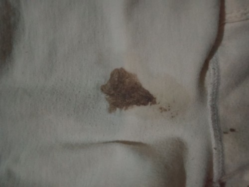 Hi mommies.4weeks & 2days preggy po ako.May lumabas sakin na color dark brown.normal lang po ba to?