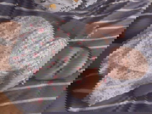 หัวน้องเป็นแบบนี้จะหายไหมค่ะ