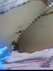 Kemerahan pada kulit bayi 3 bulan