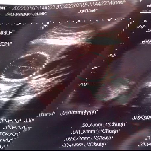 #อยากสอบถามแม่ๆค่