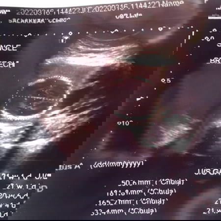 #อยากสอบถามแม่ๆค่