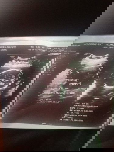 Anu magandang gawin ko para ma inormal kong ipanganak si baby