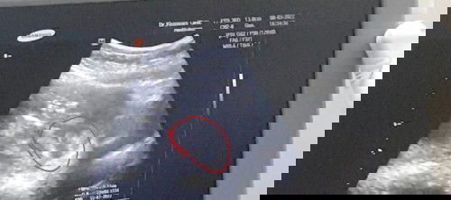 สวัสดีค่ะ อยากจะรบกวนแม่ๆ ช่วยดูให้หน่อยค่ะ ว่า ญ หรือ ช หมอบอกโอกาสเป็น ญ 60% จ้า แต่ยังไม่ฟันธง