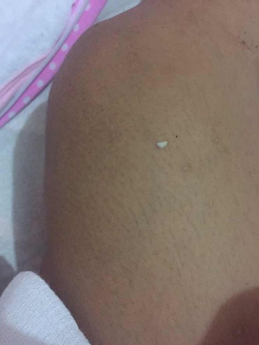 Hello po mga momsh 6 days palang po baby ko and now bahing sya ng bahing and parang may halak po sya?ano po pwede gawin?