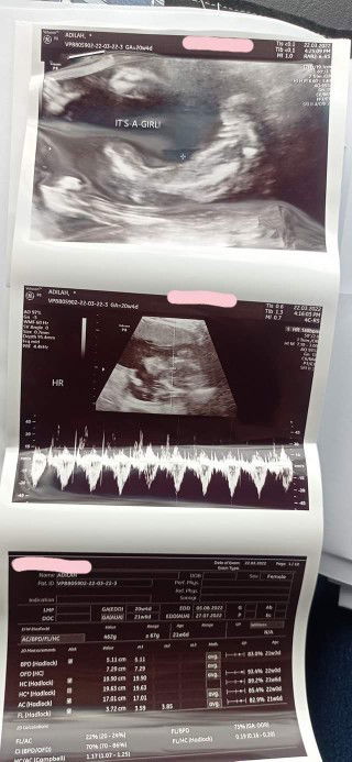 Alhamdulillah 21 week❤️