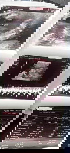 Alhamdulillah 21 week❤️