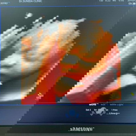 แชร์รูปเบบี้กันจ้าา