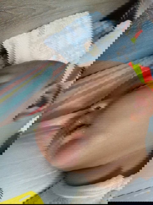 หน้าลูกเป็นแดงๆดวงๆค่ะ