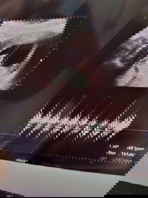 ขอดูใบซาวด์10-11Wของแม่ๆหน่อยค๊า