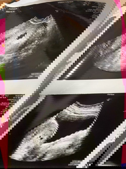 ช่วยอ่านหน่อยนะคะ เครียดมากเลย