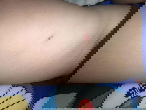 แม่ๆเคยเป็นไหม