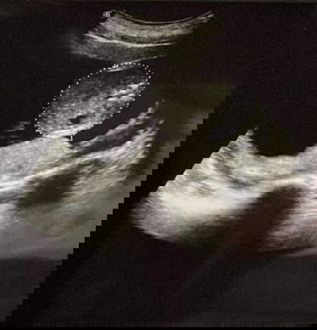 ดูรูปกันยังไงหรอคะ ดูไม่ออกเลยค่ะ ดูไม่เป็นด้วยค่ะ😅