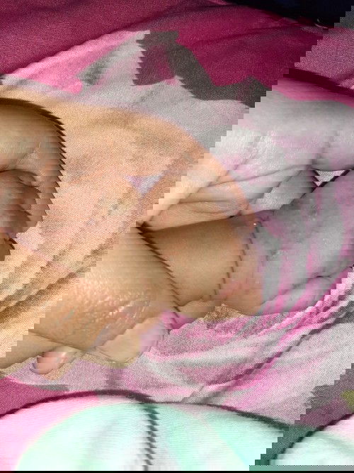 Bintik Merah di Tangan