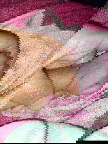 Bintik Merah di Tangan