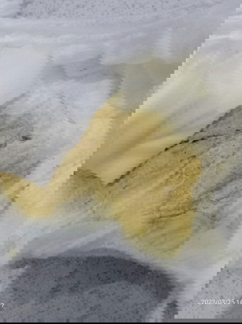 Fesesnya bormal tdk ya?