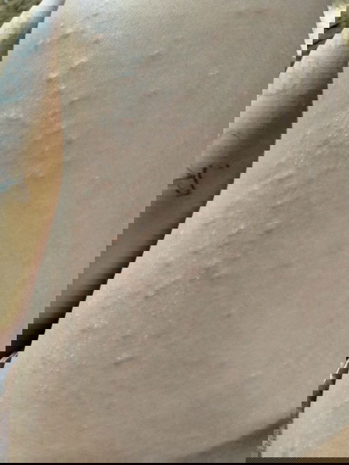 คุณแม่บ้านไหนเป็นผื่นตอนตั้งครรภ์บ้างค้ะมันเป็นอันตรายต่อเด็กไหมค้ะเป็นตรงท้องรามมาขาแล้วจ้ะ