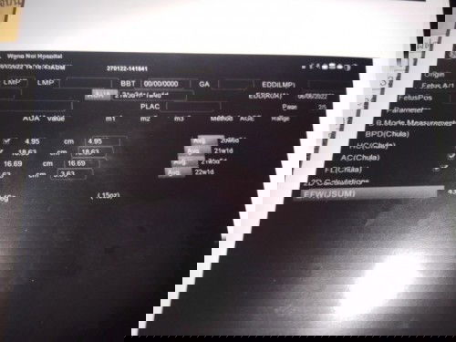 อยากรู้คะ น้ำหนักลูกอยู่ตรงไหน🙏