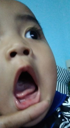 ปากและลิ้น