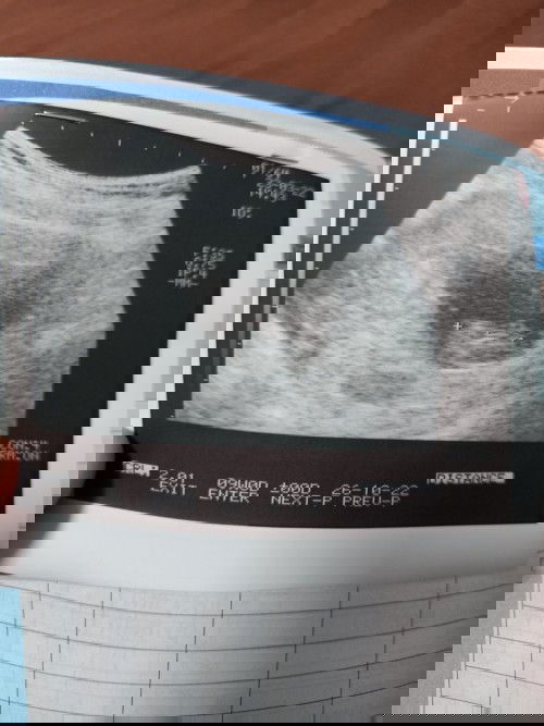 ซาวด์เจอน้องกับเสียงหัวใจตอนกี่วีคคะ