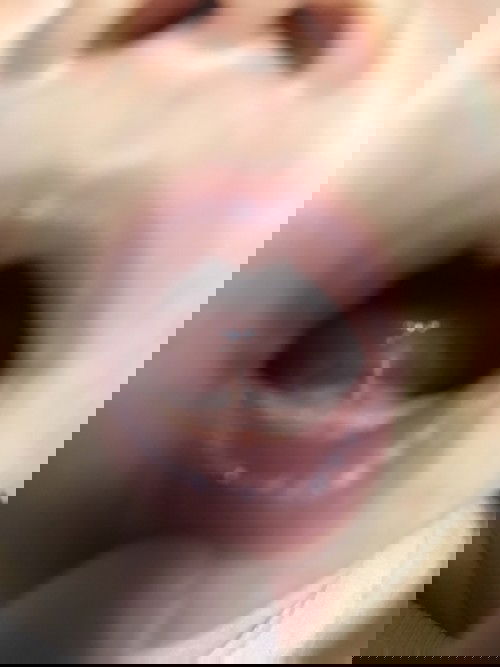 Tie tounge po ba baby ko?