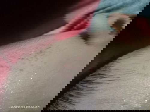 Tiba tiba muncul titik titik merah di kulit kepala bayi