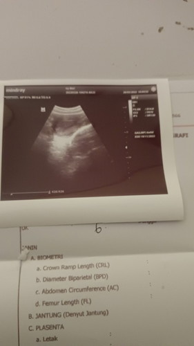 Di umur debay 5 minggu blm keliatan kantong dan janin nya. Sedih