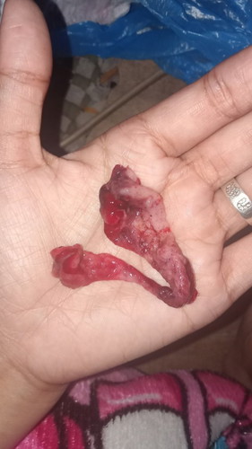 Sa regla po ba ito o miscarriage?