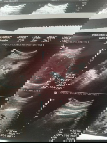บำรุงลูกในท้องยังไงให้น้ำหนักดี