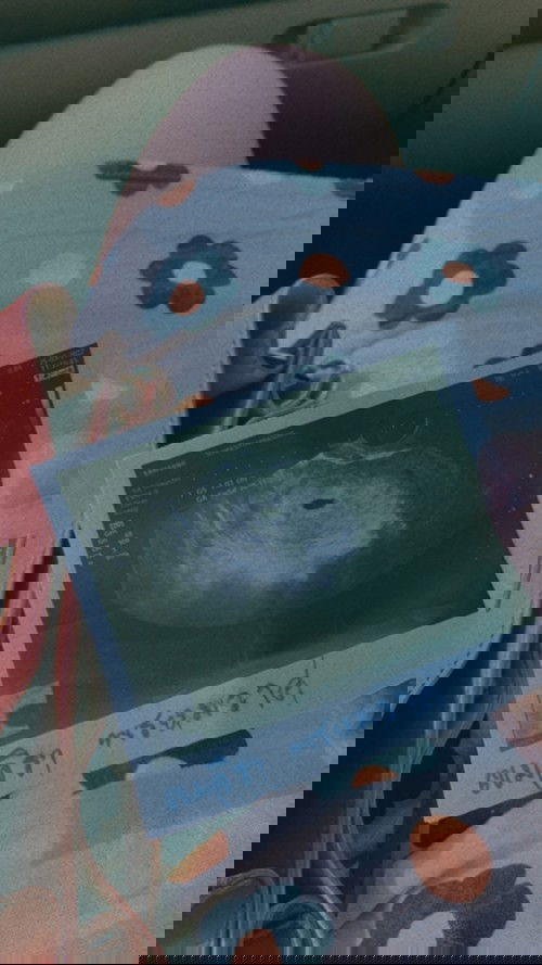 เจอถุงครรภ์เเล้วค่าาา 😊