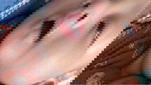 Kulit bayi 5 bulan bruntusan