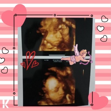 ทีม มิ.ย 65 ลูกสาว👼👼