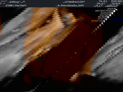 Galau masih bimbang ,,hhehe