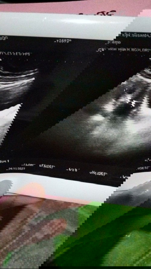 Assalamu'alaikum wr.wb