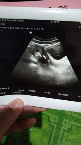 Assalamu'alaikum wr.wb