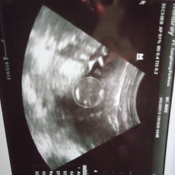 Perkembangan si kecil