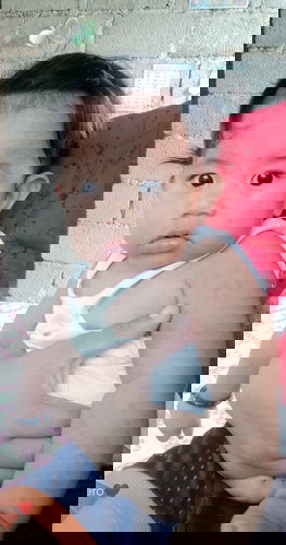 Rashes sa kamay ni baby