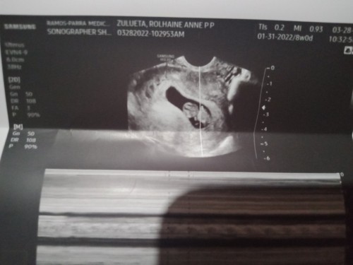 163 heart beat per minutes 9 weeks pregnant