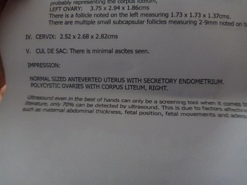 Asking for my ultrasound result