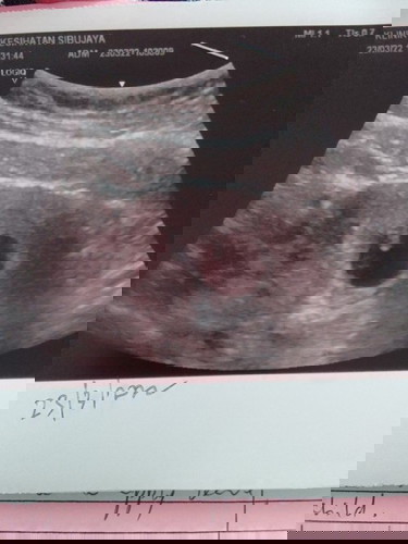 Saya tak pasti sngat