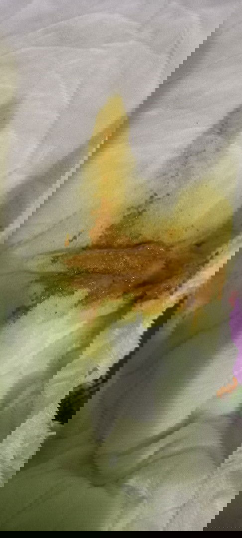 Poop bayi normal atau diare