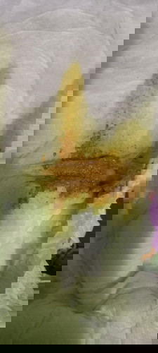 Poop bayi normal atau diare