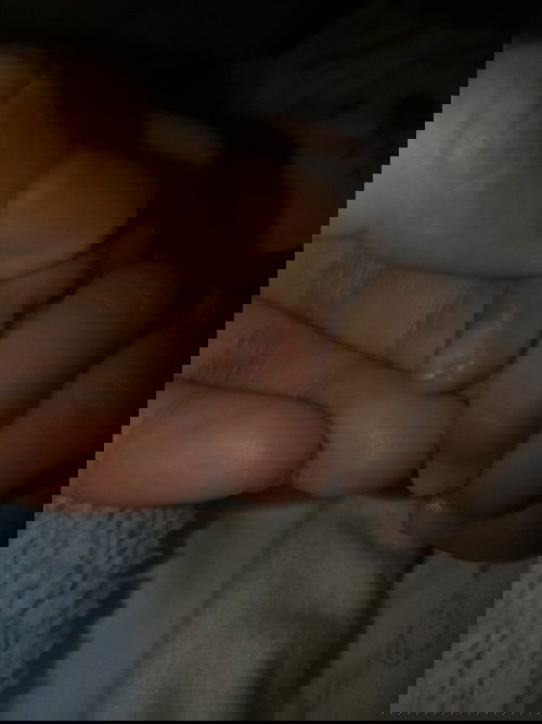 Kulit jari kena potongan kuku