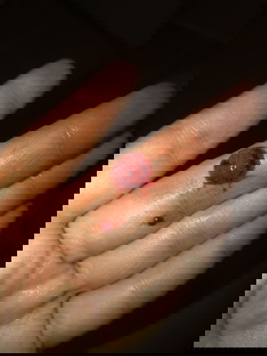 สอบถามแบบนี้แท้งไหม